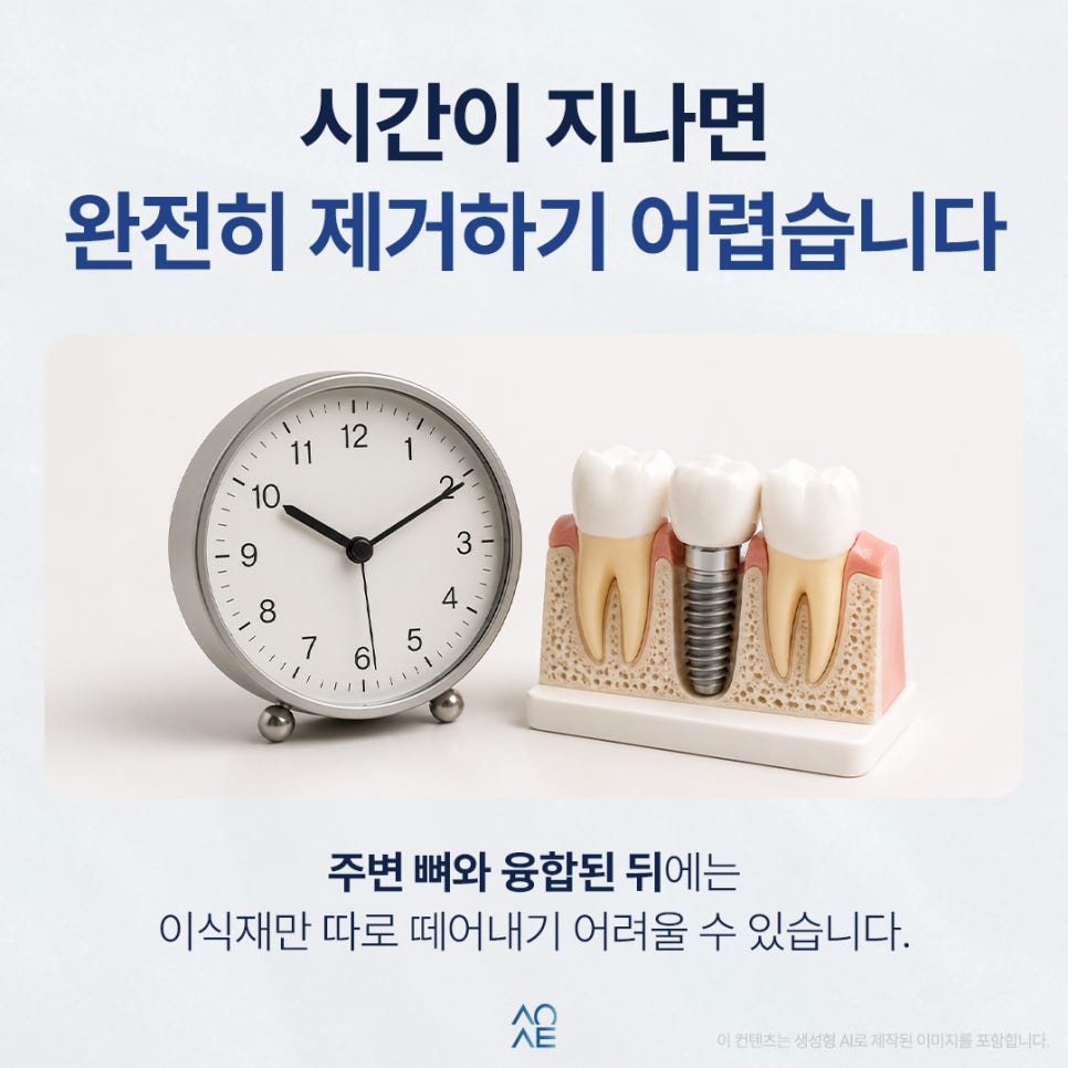 임플란트 뼈이식 재료 완전히 제거하고 싶은데 가능한가요? 관련 이미지 4