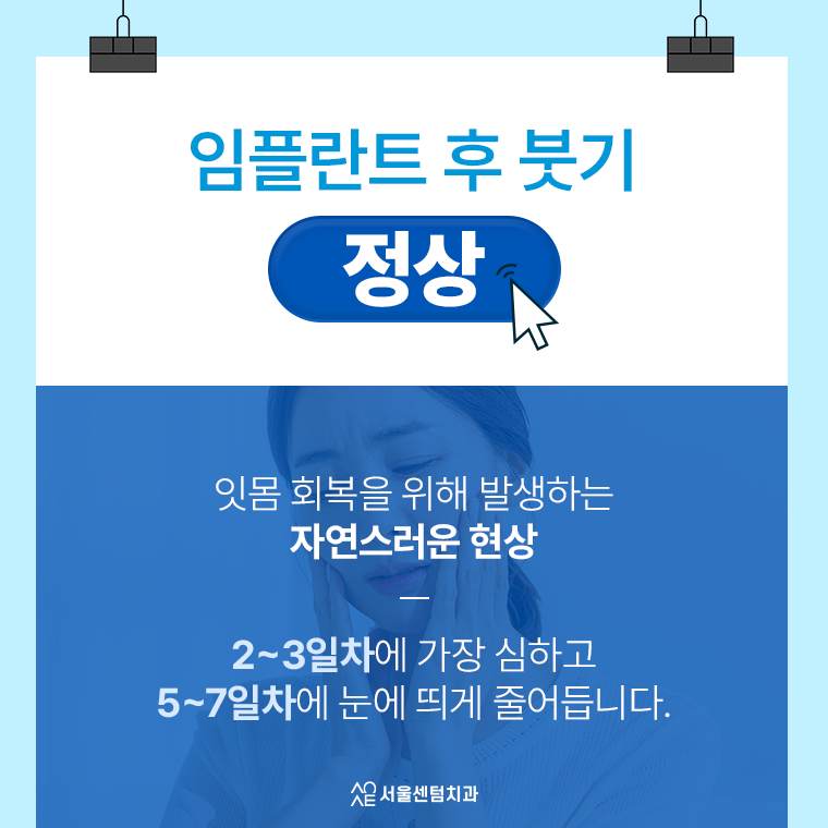 임플란트 붓기 정상인지 애매모호하다면 관련 이미지 2