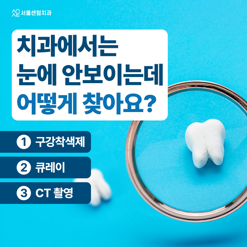 치아깨짐 비용 많이 나와 어금니 레진 고려한다면 알아두어야 할 것 관련 이미지 4