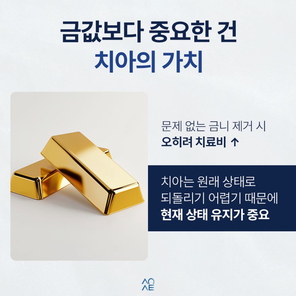 금니 판매 시세 금액 얼마나 이득볼까? 치료비도 계산해 본다면 관련 이미지 6