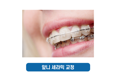 총생 앞니 덧니 발치 후 치아교정? 관련 이미지 8