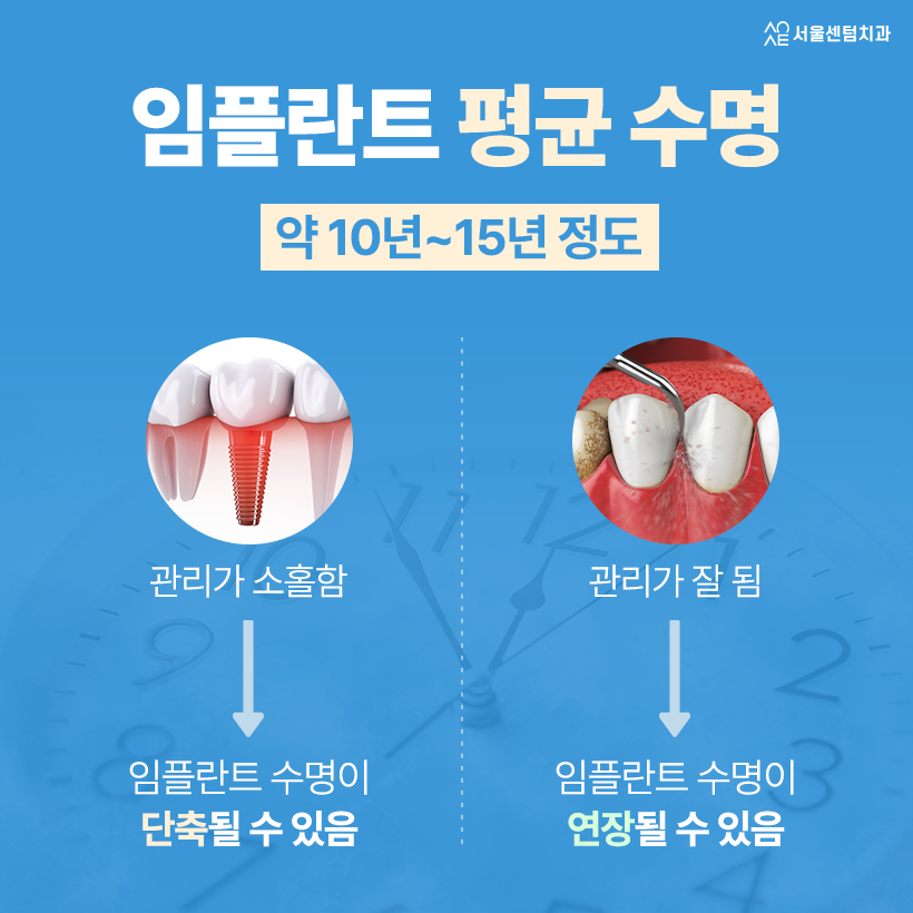임플란트 사용기간 몇 년인지 궁금해요 오래 쓰는 노하우는? 관련 이미지 3