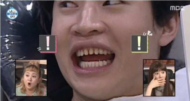 강남 라미네이트 치과 치아삭제 최소화 관련 이미지 2