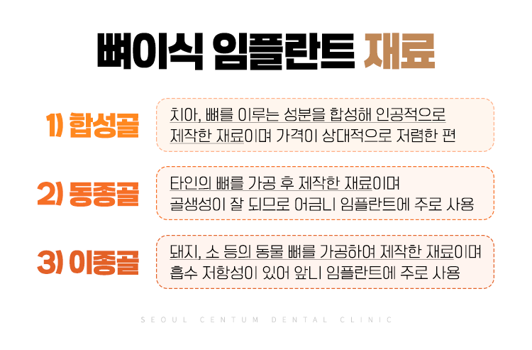 치아 뼈이식 비용 얼마로 산정될까? 관련 이미지 5