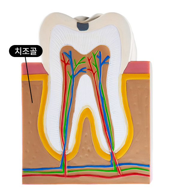 앞니 임플란트 식립으로 저작 기능을 끌어올린 증례 관련 이미지 2