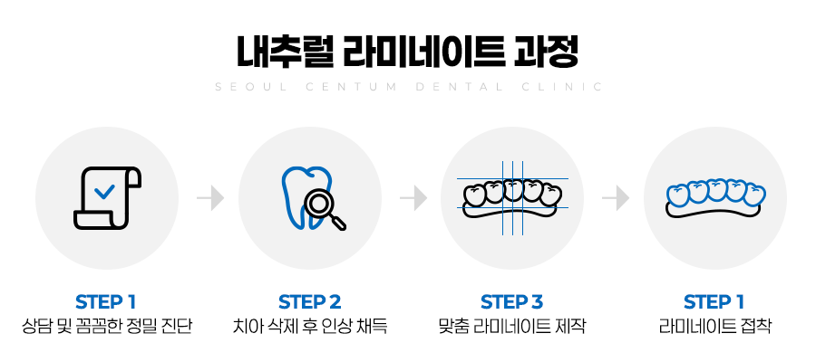 라미네이트전후 치아의 가지런한 정도와 밝기 차이 확인하기 관련 이미지 3