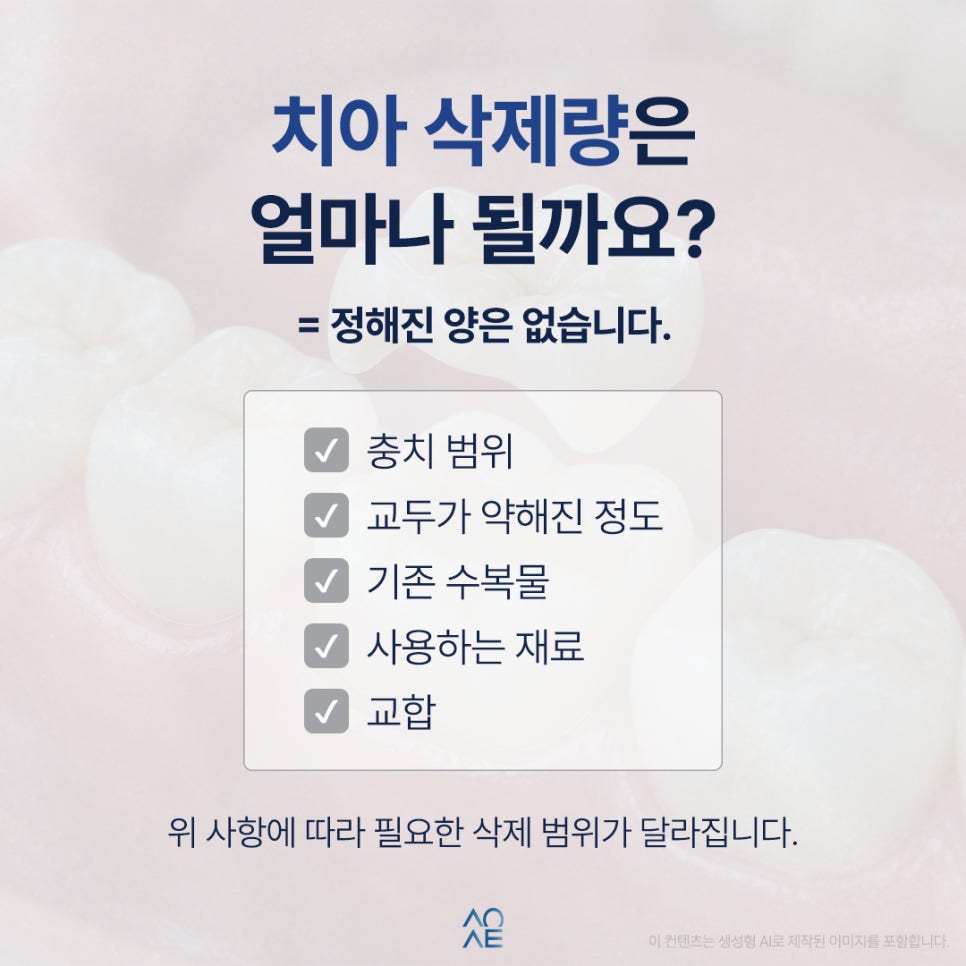 오버레이 크라운 치아를 얼마나 깎나요 심미 목적으로 해도 될지 궁금해요 관련 이미지 3