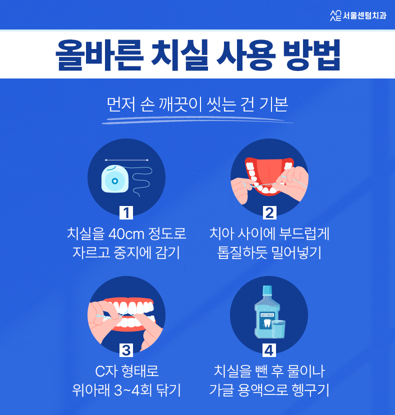 임플란트 치실 이 시기부터 이렇게 사용하세요 관련 이미지 4