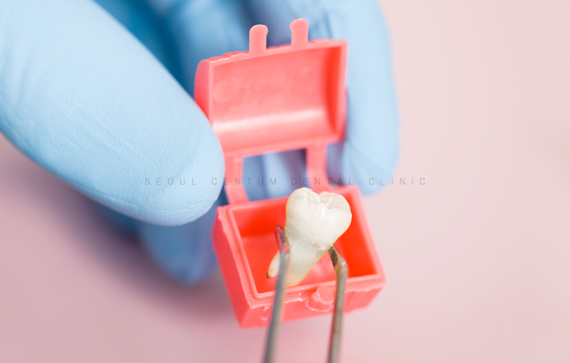 임플란트잘하는곳 해당되면 이러한 이유 때문일지도 모릅니다. 관련 이미지 8