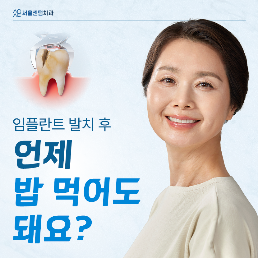 임플란트 발치후 식사 바로 가능할까요 식단 가이드 A to Z 관련 이미지 1