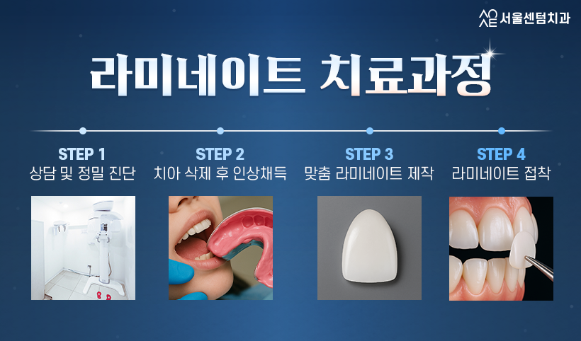 강남 라미네이트 치과 치아삭제 최소화 관련 이미지 6