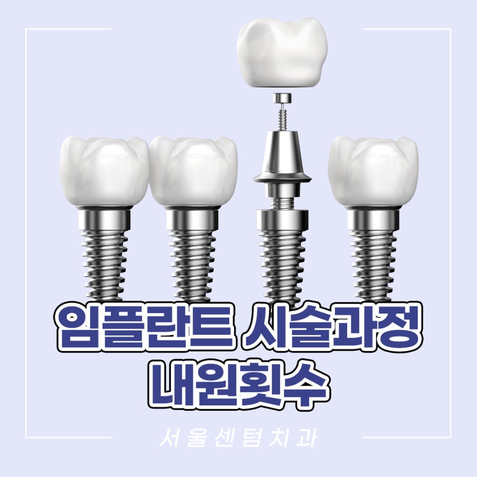 임플란트 시술과정 총 몇번 치과에 가야할까? 관련 이미지 6