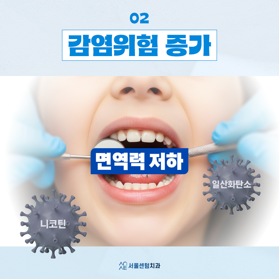 임플란트당일흡연 굳이 문제 생길 일 있을까요 하다가 큰일납니다 관련 이미지 3