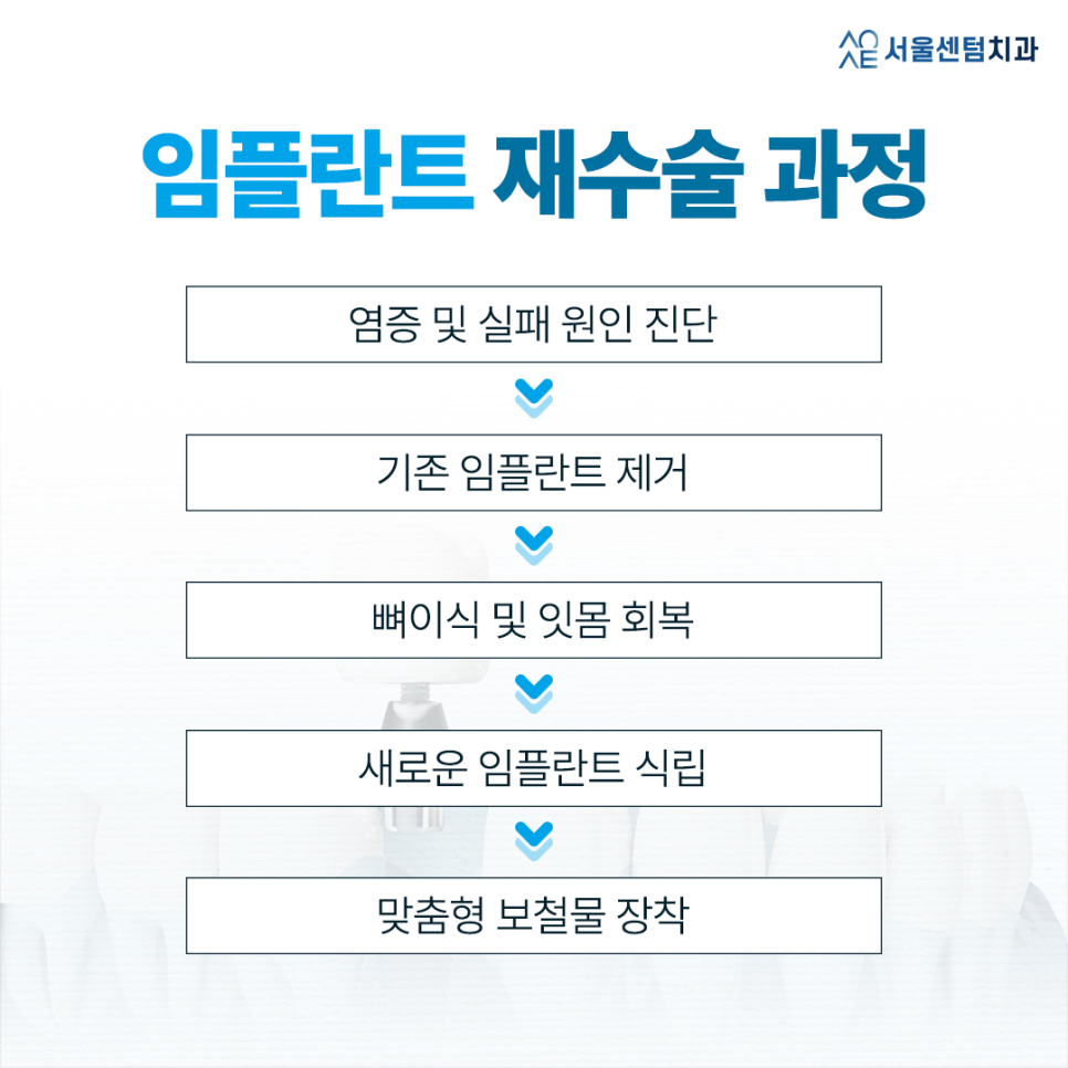 임플란트재수술 꼭 해야하는 경우는? 관련 이미지 4