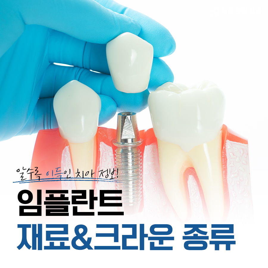 임플란트 크라운 종류 토요일과 일요일도 여는 치과에서 안내! 관련 이미지 2