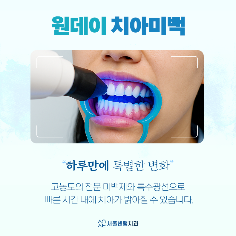 강남 치아미백 시간, 효과, 방법 한눈에 확인 관련 이미지 4
