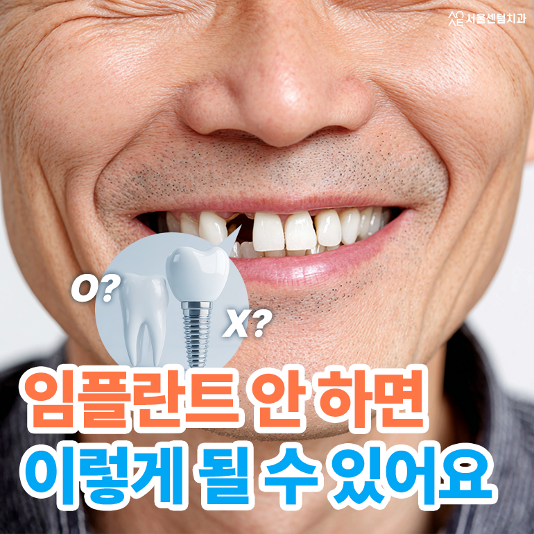 임플란트 안하면 추후 이런 결과가 발생할지도 관련 이미지 1