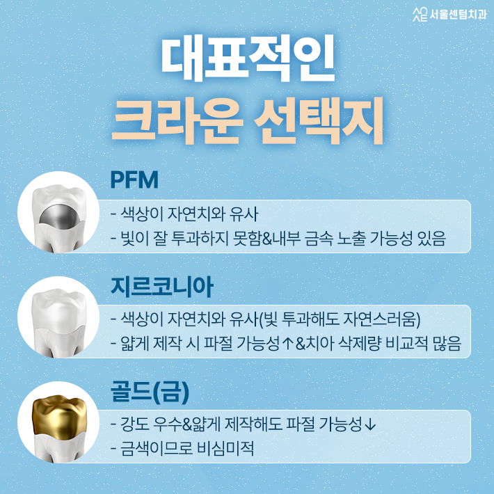 신경치료 시 크라운 수명이 달라지는 원인은 종류 때문일까 관련 이미지 4