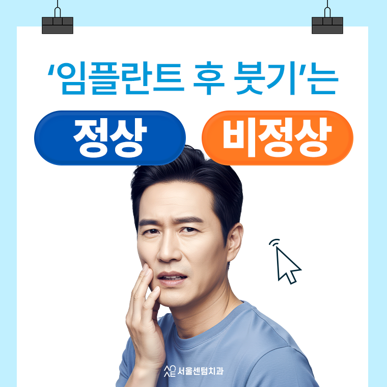 임플란트 붓기 정상인지 애매모호하다면 관련 이미지 1