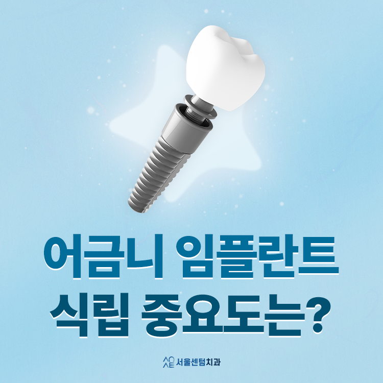 어금니 임플란트 앞니보다 신중해야 한다? 숨은 진실 관련 이미지 1