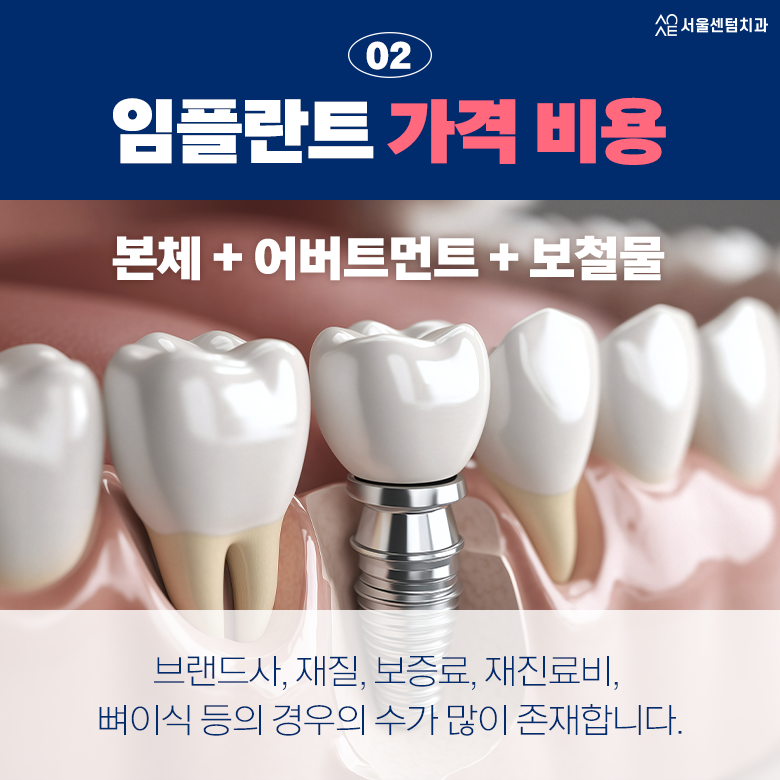 20대 임플란트 비용 후기 수명 문의 후회 없는 선택을 위해 정리해드려요 관련 이미지 3