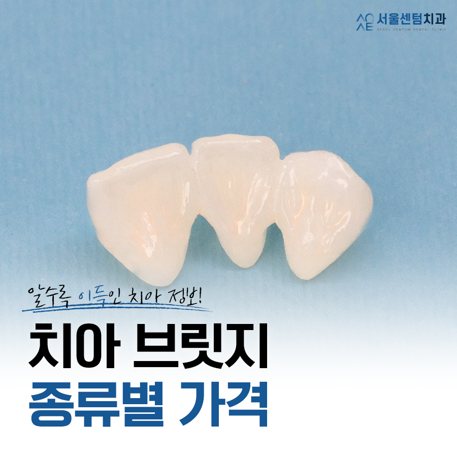 치아브릿지가격 종류에 따른 안내와 장단점 설명 관련 이미지 1