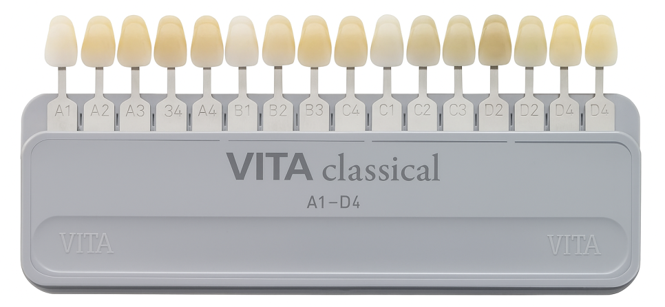 선유도 치과 원데이 치아미백 : 정말 누렁니 개선될까? 관련 이미지 1