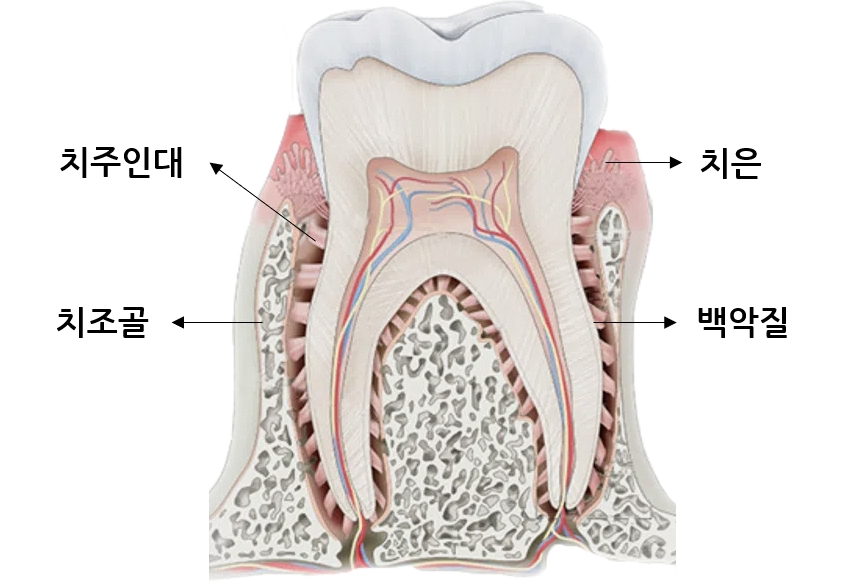Why a Tooth Crown Is Needed After Root Canal Treatment at a Dental Clinic Near Yeongdeungpo-gu Office Station image 7
