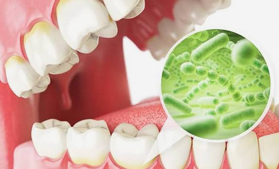 Why the Rubber Dam in Your Mouth Is Essential During Root Canal Treatment at a Dangsan Station Dental Clinic image 2