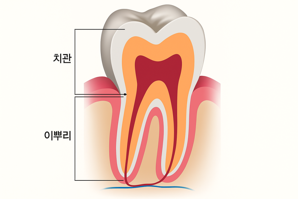 당산동 치과 앞니 파절 : 치관확장술이 필요할 수 있습니다. 관련 이미지 2