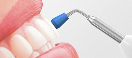 Seonyudo Station Dental Clinic Explains the Essential Steps to Take When a Tooth Is Injured image 6