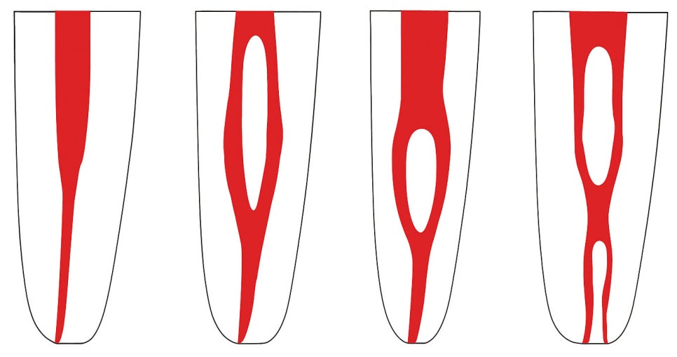 당산역 치과 : 보이지 않는 신경을 찾는 방법, 치아 치료 시 사용하는 미세현미경 관련 이미지 3
