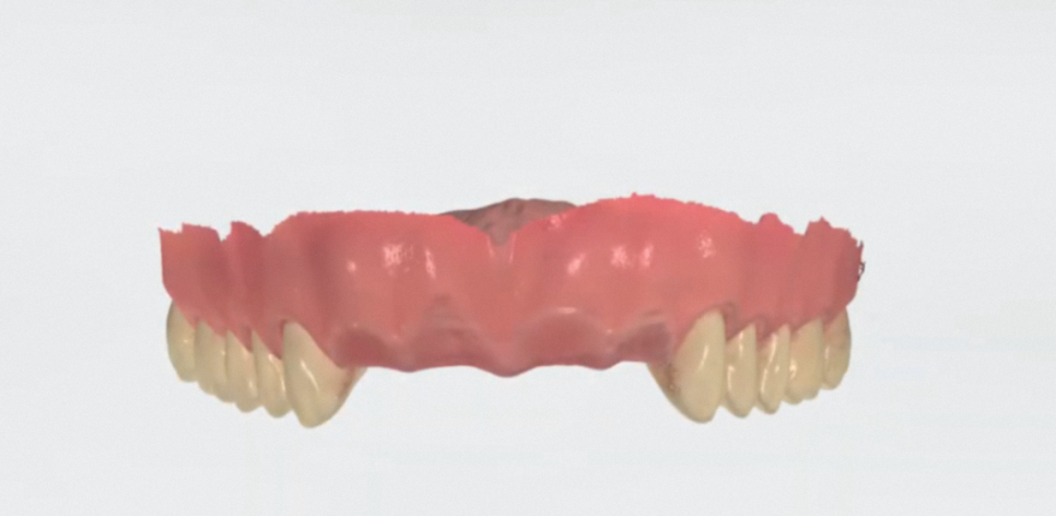 The Process of Creating Aesthetic Prosthetics Using a 3D Oral Scanner at the National Assembly Building Dental Clinic! image 10