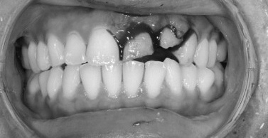 Seonyudo Station Dental Clinic Explains the Essential Steps to Take When a Tooth Is Injured image 4