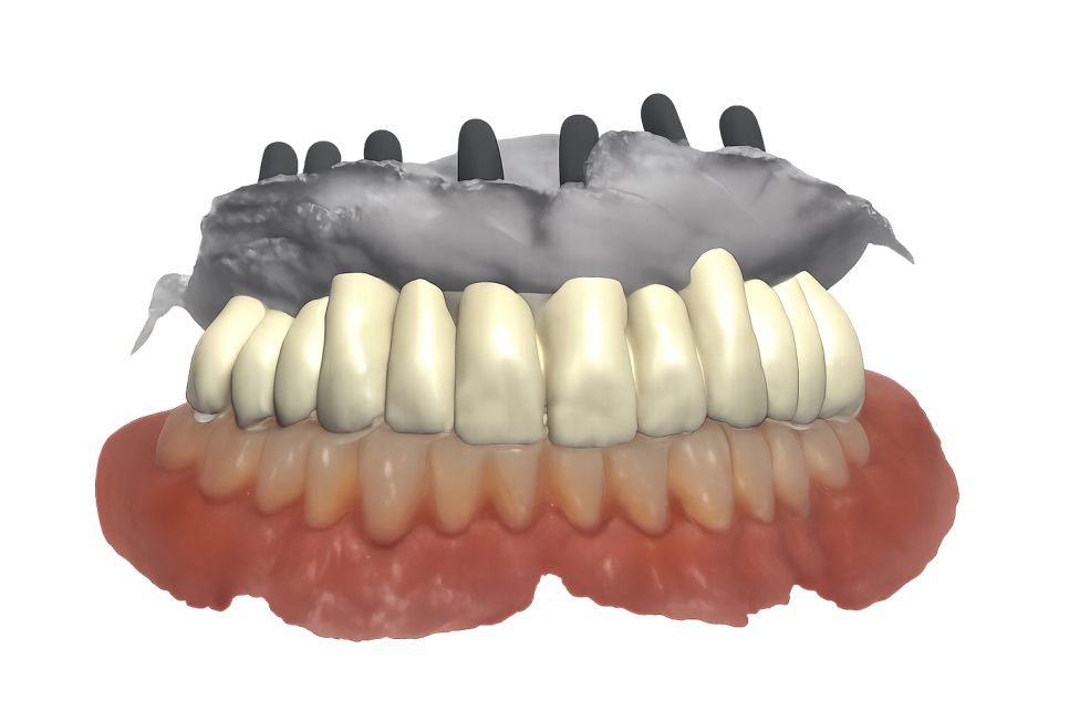 선유도역 치과 네이게이션 임플란트, 어떻게 진행될까? 관련 이미지 6