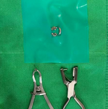 Why the Rubber Dam in Your Mouth Is Essential During Root Canal Treatment at a Dangsan Station Dental Clinic image 7