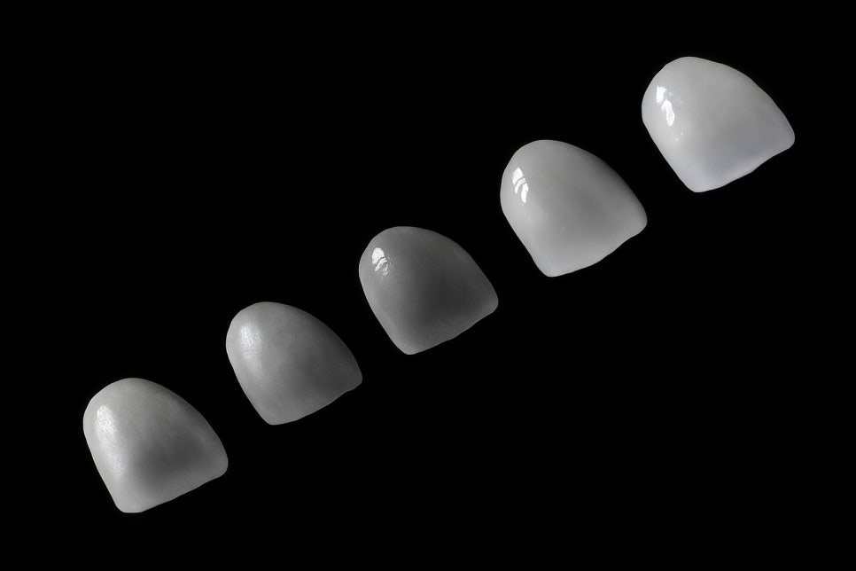 라미네이트, 보존과 전문의에게 받아야 되는 이유를 당산역 치과 에서 알려드립니다. 관련 이미지 3