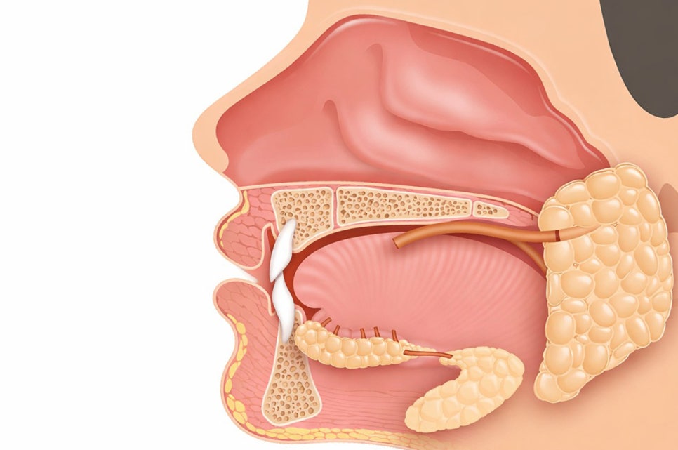 선유도 치과 다발성 우식증으로 이어질 수 있는 구강 건조증 어떻게 예방할 수 있을까? 관련 이미지 4