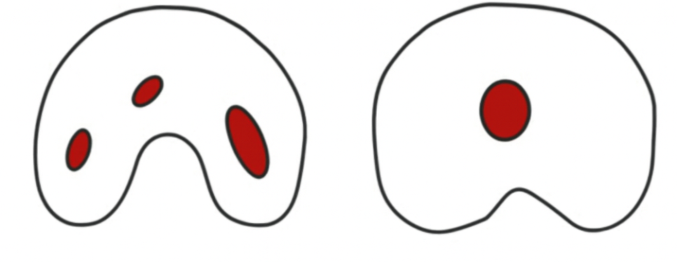 자연치 보존을 방해하는 C형 근관 : 당산동 치과 신경치료 관련 이미지 4