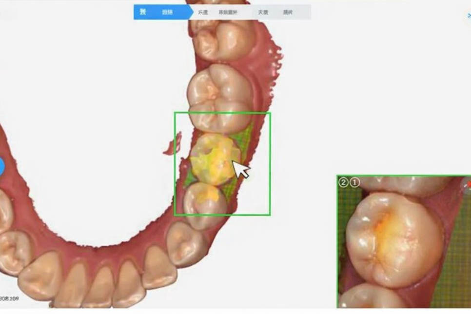 선유도역 치과 네이게이션 임플란트, 어떻게 진행될까? 관련 이미지 3