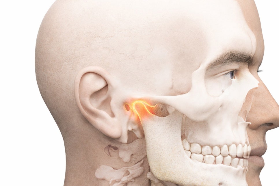 이갈이 & 이 악물기 예방 당산 턱관절 치과 보톡스 및 스플린트 관련 이미지 1