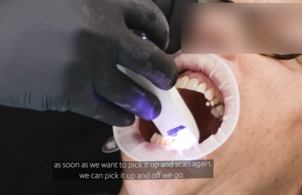 The Process of Creating Aesthetic Prosthetics Using a 3D Oral Scanner at the National Assembly Building Dental Clinic! image 3