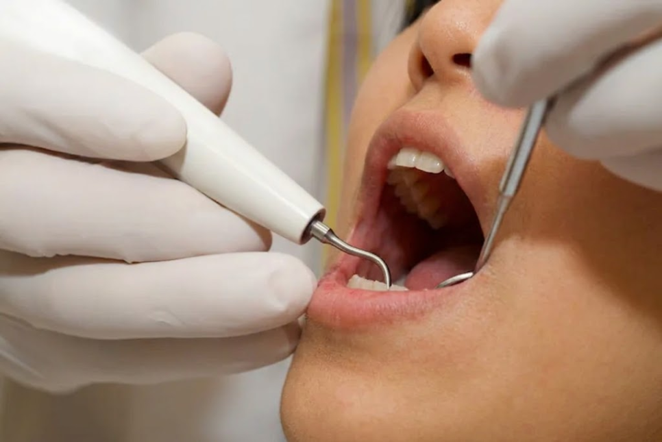 Severe Periodontitis: The Name Is "Pungchi" — Prevention Tips from Dangsan Station Dental Clinic image 6