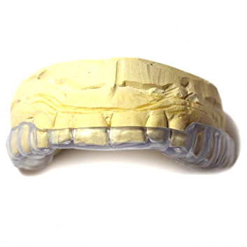 Yeongdeungpo-gu Office Station Dental Clinic: Tooth Wear—Is It Okay to Leave Teeth That Are Gradually Wearing Down Alone? image 4