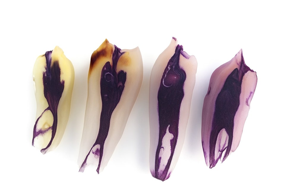 당산역 치과 : 보이지 않는 신경을 찾는 방법, 치아 치료 시 사용하는 미세현미경 관련 이미지 6