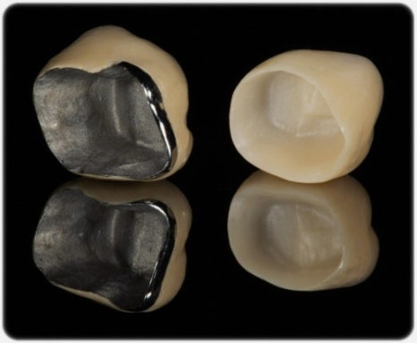 Why a Tooth Crown Is Needed After Root Canal Treatment at a Dental Clinic Near Yeongdeungpo-gu Office Station image 6