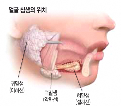 Dangsan Station Dental Clinic: Does Your Mouth Keep Feeling Dry? The Connection Between Dry Mouth and Cavities image 1