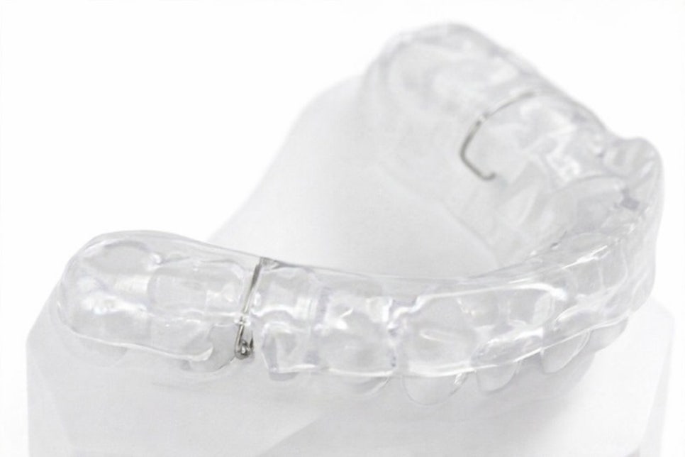 이갈이 & 이 악물기 예방 당산 턱관절 치과 보톡스 및 스플린트 관련 이미지 6